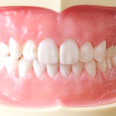 ���C���[����