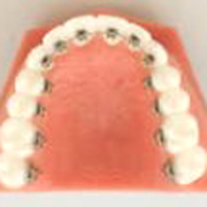 ���C���[����