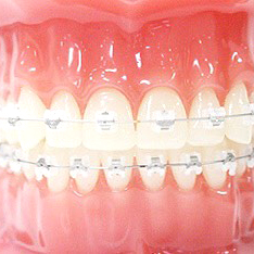 ���C���[����